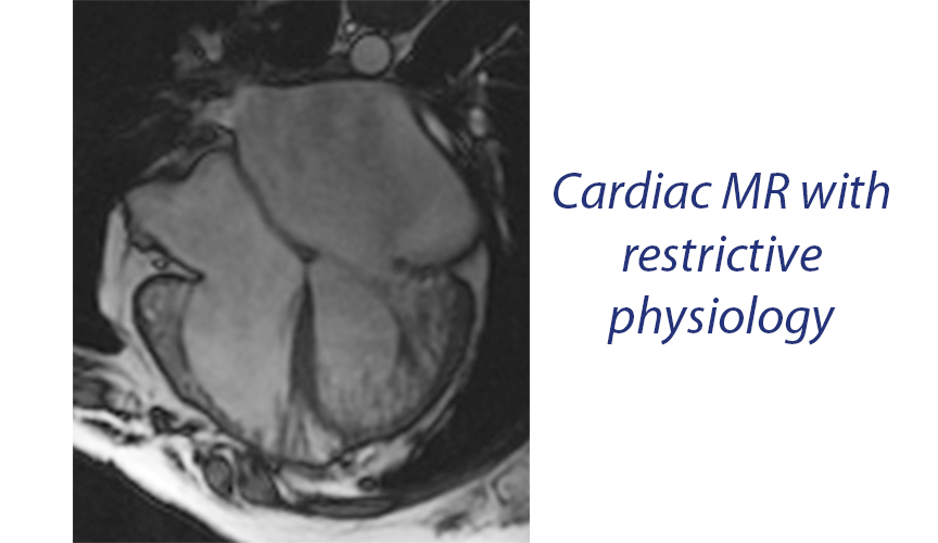 cardiac MR